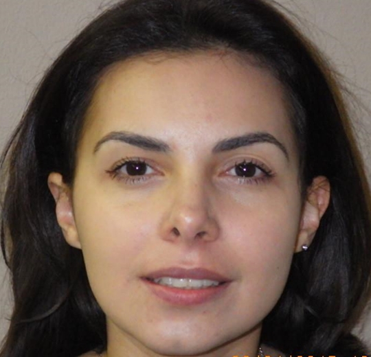 Bouche ouverte, lèvres relâchées