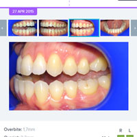 Surveillance orthodontique.